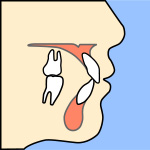 正しい噛み合わせ