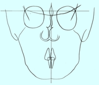 正貌頭部X線規格写真のトレース