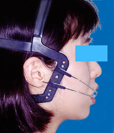 Jフック・ヘッドギア（側面）