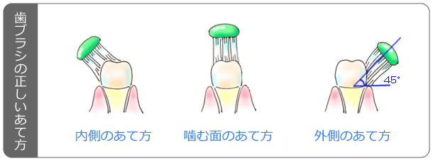 歯ブラシの正しいあて方